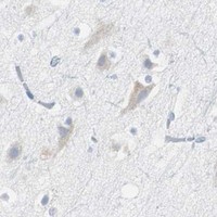 HPA IHC Cerebral cortex — RPS12