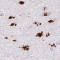 HPA IHC Cerebral cortex — SRSF1