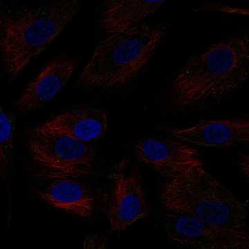HPA006134: hTERT-RPE1