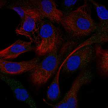 HPA006134: EFO-21