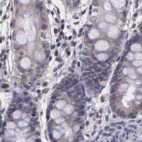 HPA IHC Colon — CDC45