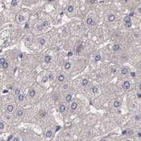 HPA IHC Liver — CDC45