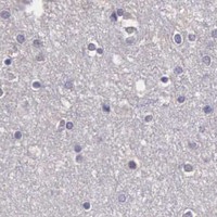 HPA IHC Cerebral cortex — CDC45