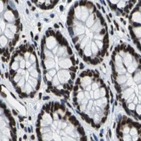 HPA IHC Colon — FUBP1