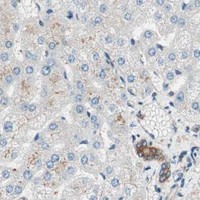 HPA IHC Liver — TSG101