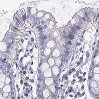 HPA IHC Colon — CALHM1