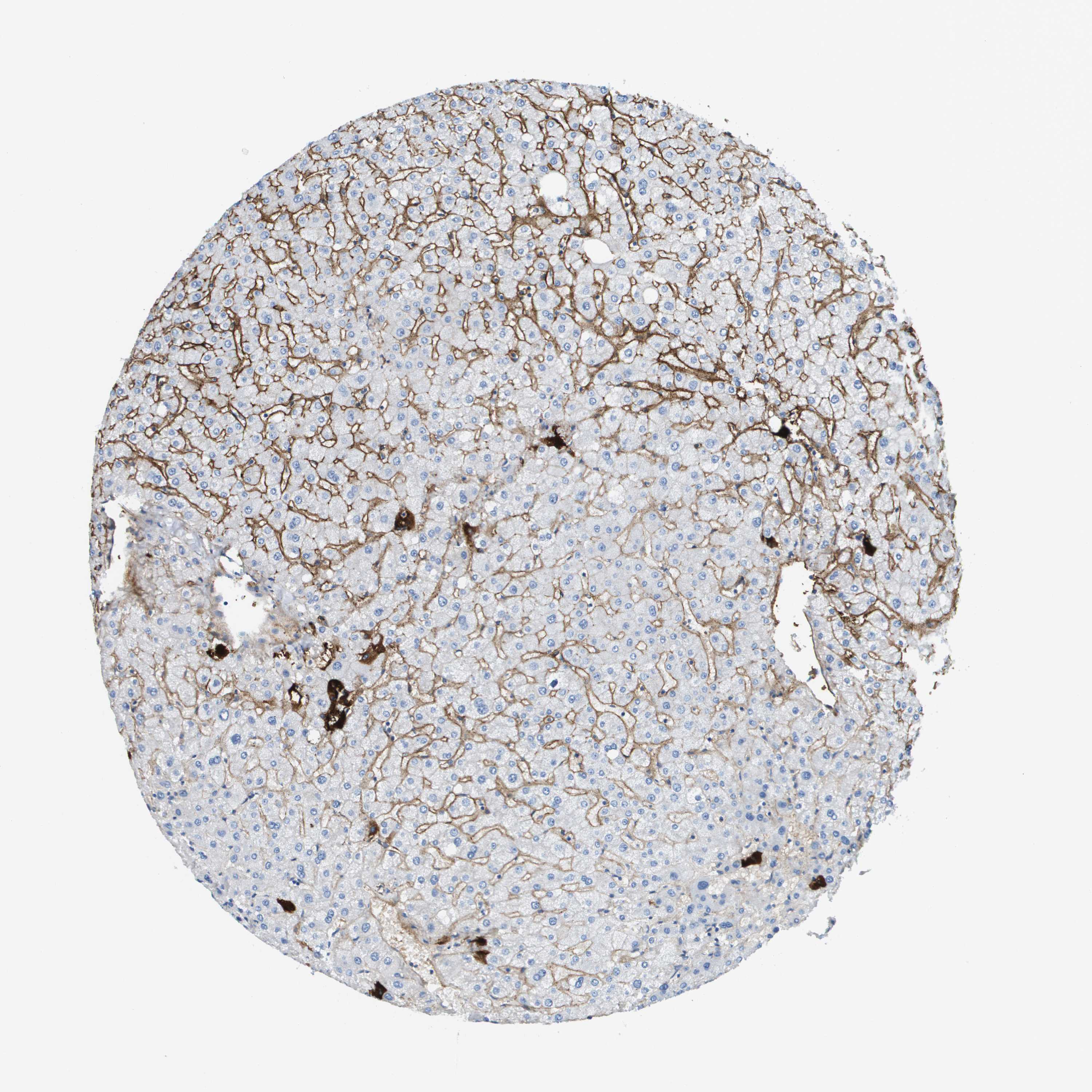 Tissue expression of SDC1 Staining in liver The Human Protein Atlas