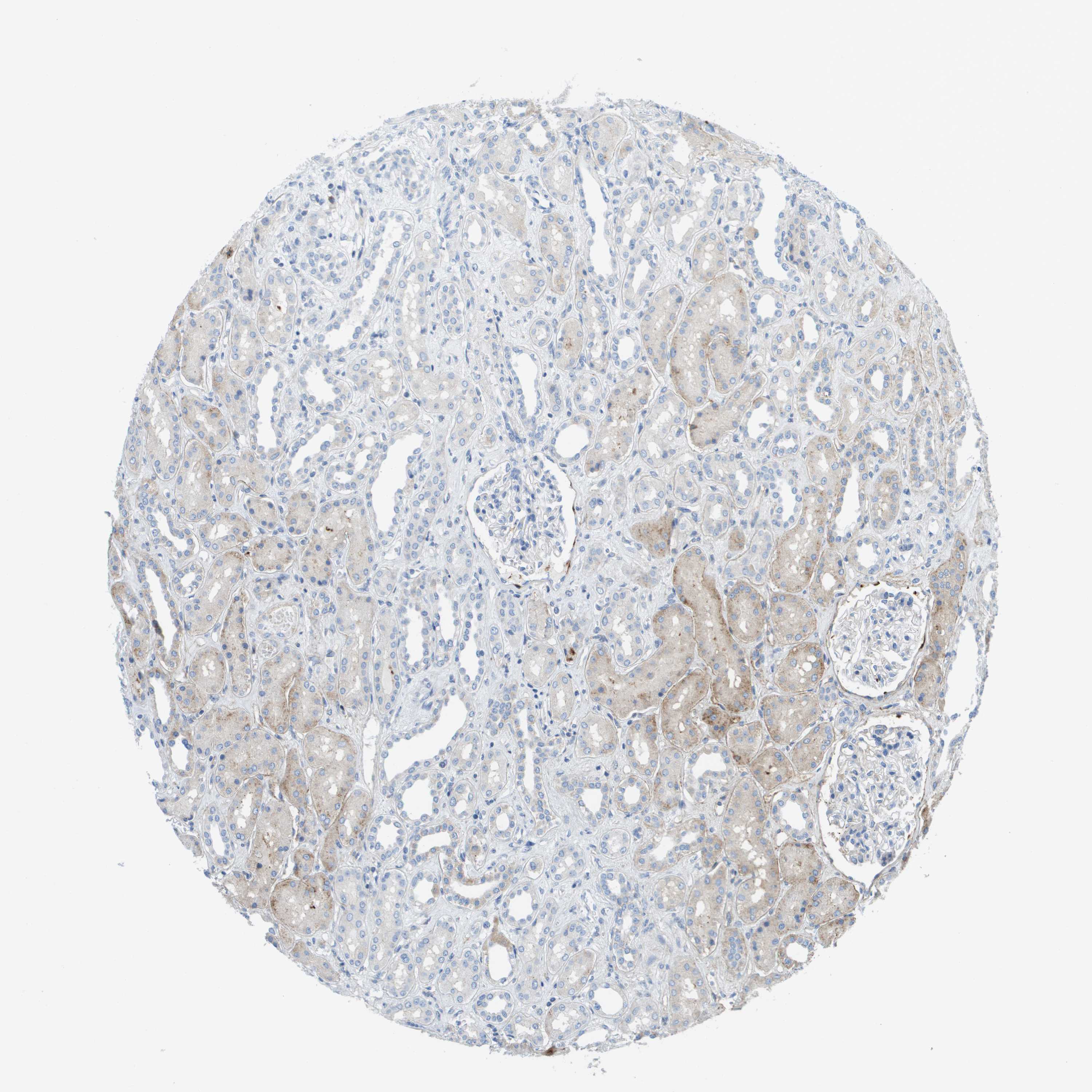 Tissue expression of SDC1 Staining in kidney The Human Protein Atlas