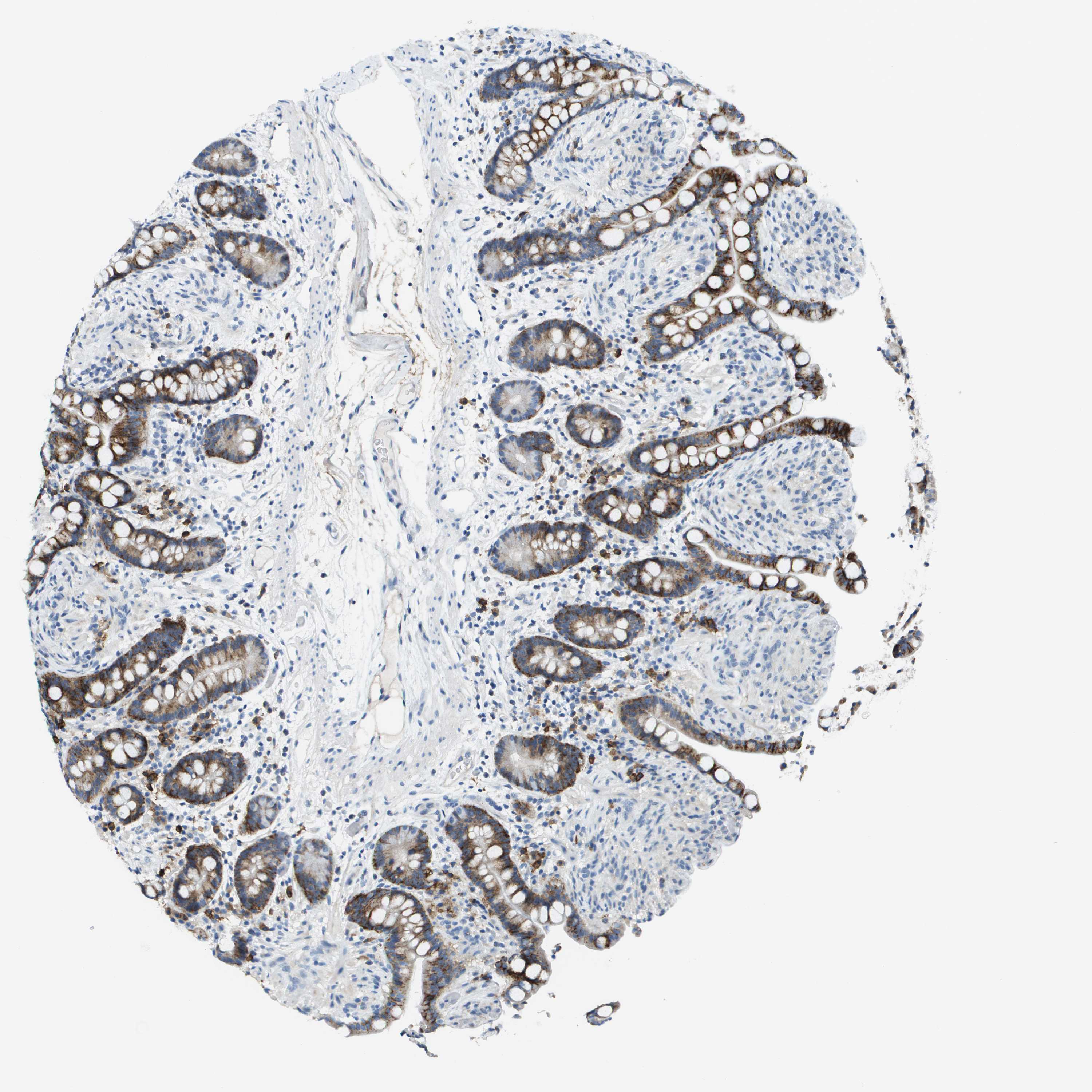 Tissue expression of SDC1 Staining in colon The Human Protein Atlas