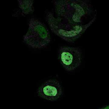 HPA061866: HeLa BAC 5198