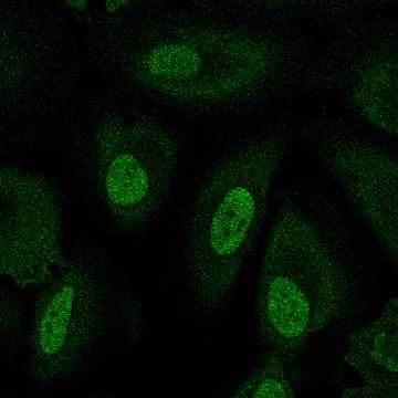 HPA061866: HeLa 