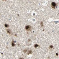 HPA IHC Cerebral cortex — RBFOX2
