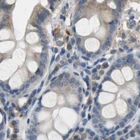 HPA IHC Colon — PI4KB