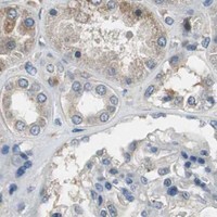 HPA IHC Kidney — PI4KB
