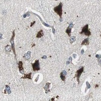 HPA IHC Cerebral cortex — PI4KB