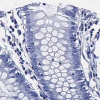 HPA IHC Colon — ENO2