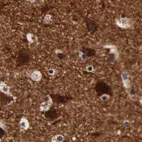 HPA IHC Cerebral cortex — ENO2