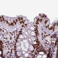 HPA IHC Colon — JUND