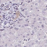 HPA IHC Liver — JUND