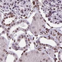 HPA IHC Kidney — JUND