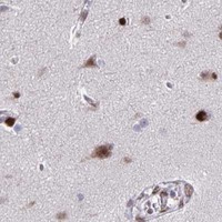 HPA IHC Cerebral cortex — JUND