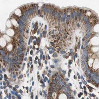 HPA IHC Colon — GSTK1