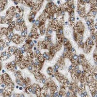 HPA IHC Liver — GSTK1