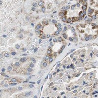 HPA IHC Kidney — GSTK1