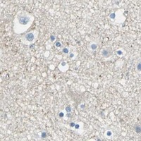 HPA IHC Cerebral cortex — AKAP12