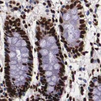 HPA IHC Colon — PABPN1