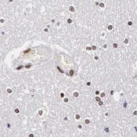 HPA IHC Cerebral cortex — PABPN1