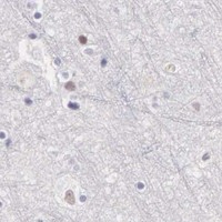 HPA IHC Cerebral cortex — ARFGAP3
