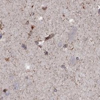 HPA IHC Cerebral cortex — ELOB