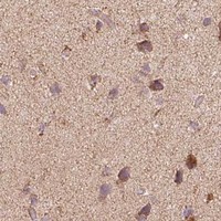 HPA IHC Cerebral cortex — CLPB