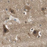 HPA IHC Cerebral cortex — ME1
