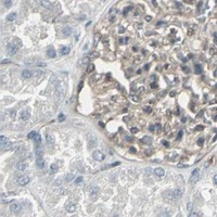 HPA IHC Kidney — PFDN1