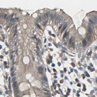 HPA IHC Colon — PFDN1