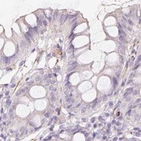 HPA IHC Colon — GRM2