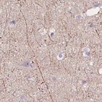 HPA IHC Cerebral cortex — GRM2