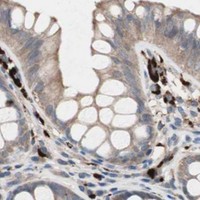 HPA IHC Colon — CCT3