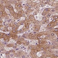 HPA IHC Liver — ACACB