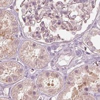 HPA IHC Kidney — ACACB