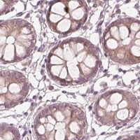 HPA IHC Colon — ACACB