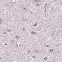 HPA IHC Cerebral cortex — ACACB