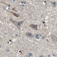HPA IHC Cerebral cortex — PRKCA