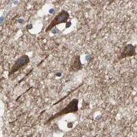 HPA IHC Hippocampus — PRKCA