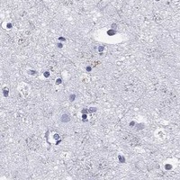 HPA IHC Cerebral cortex — GZMK
