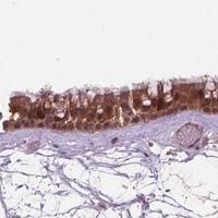 HPA IHC Nasopharynx — PLIN3