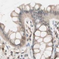 HPA IHC Colon — PSMD8