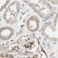 HPA IHC Kidney — PSMD8